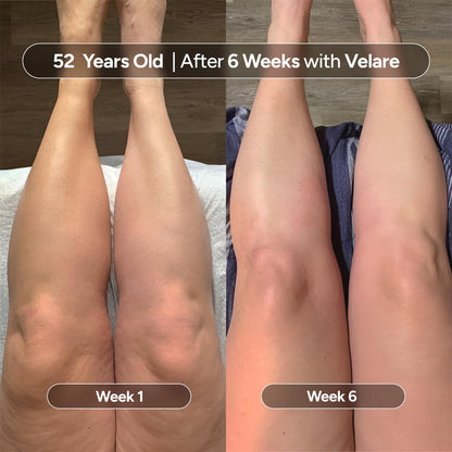 Velare Anti-Cellulite Massage Oil